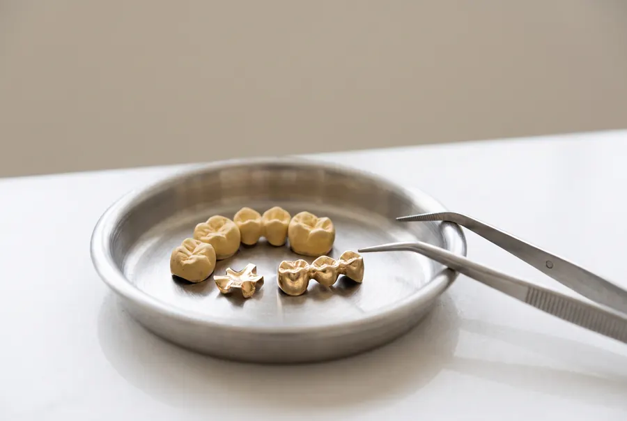 Zahngold – Kronen und Brücken in einer Edelstahlschale